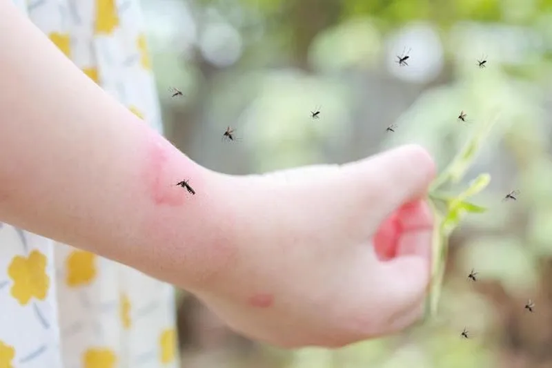 Muỗi truyền bệnh sốt xuất huyết, Zika, sốt rét nguy hiểm Muỗi truyền bệnh sốt xuất huyết, Zika, sốt rét nguy hiểm